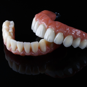 What is the Difference Between Full Jaw Implants and Dentures?