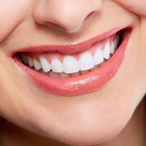 Who Is a Candidate for Smile Design?