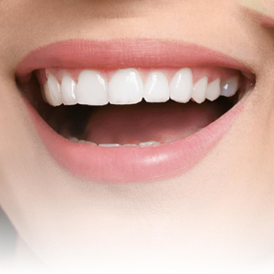 Smile Design Process