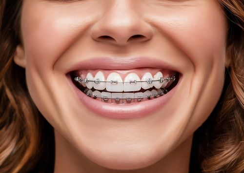 Orthodontics
