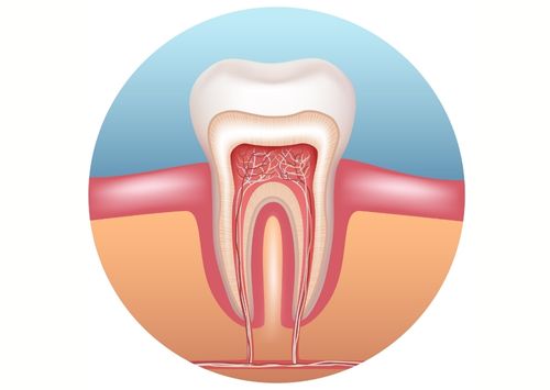 Root Canal Treatment